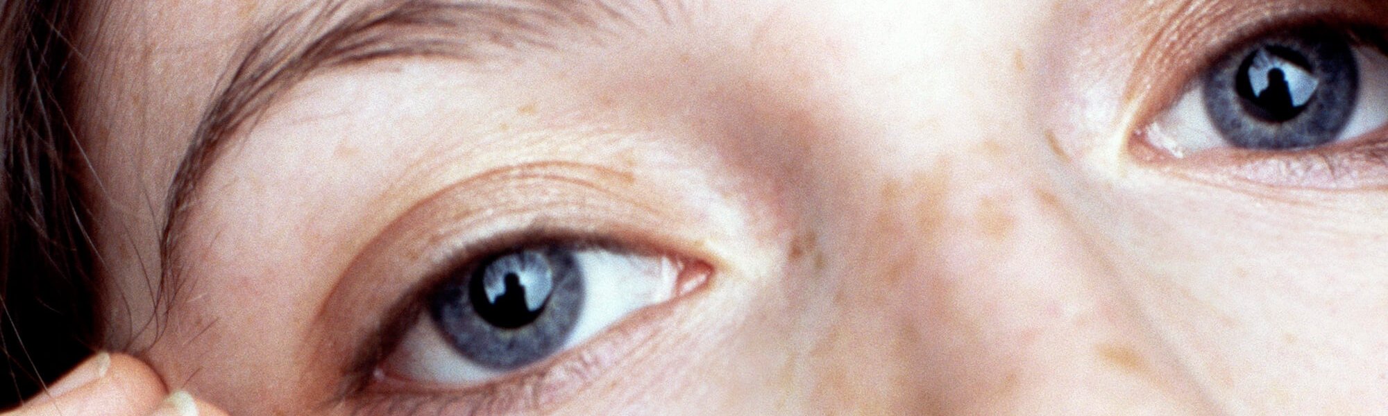 Bấm huyệt xung quanh mắt: Giải pháp cho đôi mắt trẻ trung hơn Hero