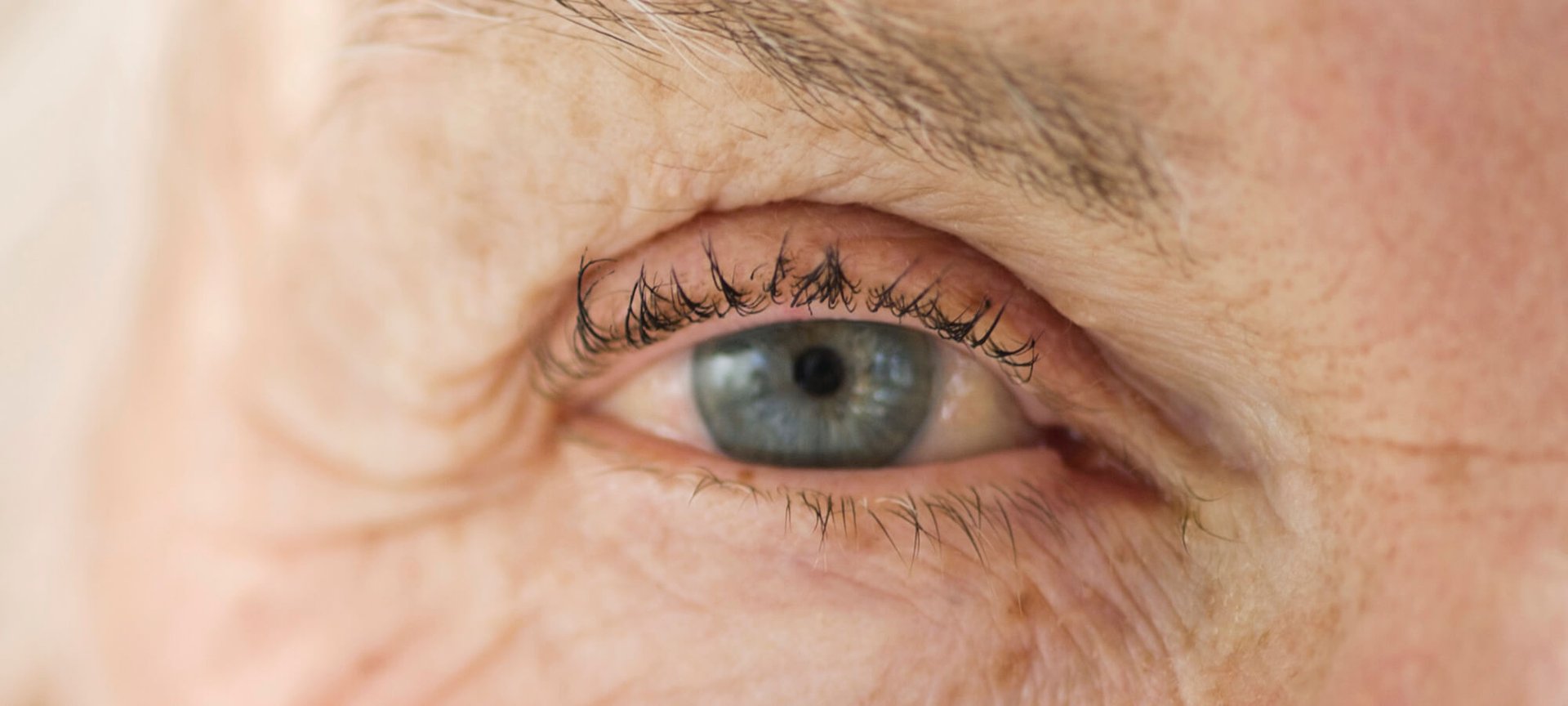 Đánh bay nếp nhăn bằng liệu pháp ánh sáng Hero